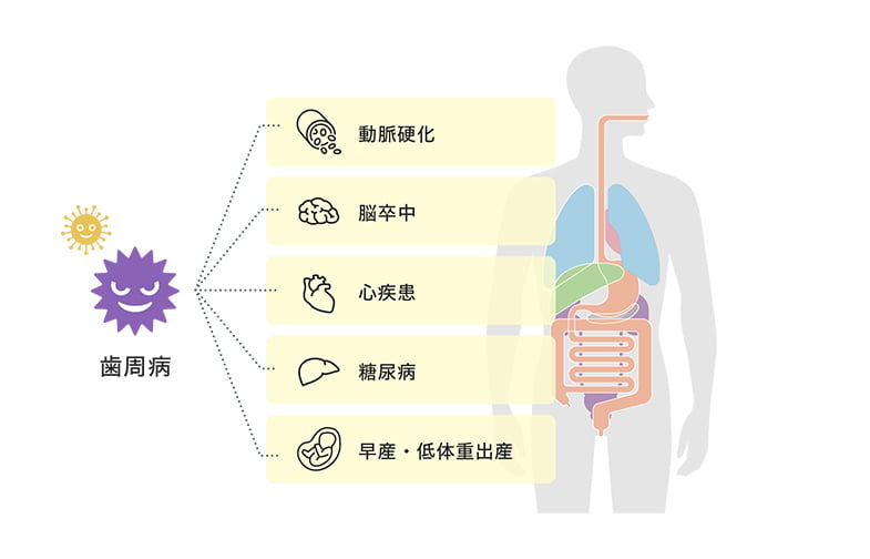 歯周病と全身疾患の関係について イメージ